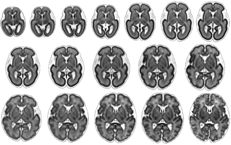 Fetal Brain Atlas weeks 21 through 37